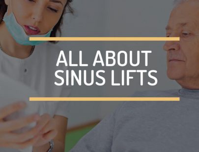 All About Sinus Lifts